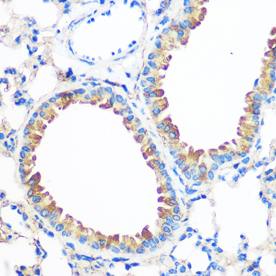 AGR2 Rabbit polyclonal antibody