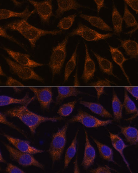 AGR2 Rabbit polyclonal antibody