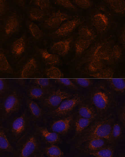 AGR2 Rabbit polyclonal antibody