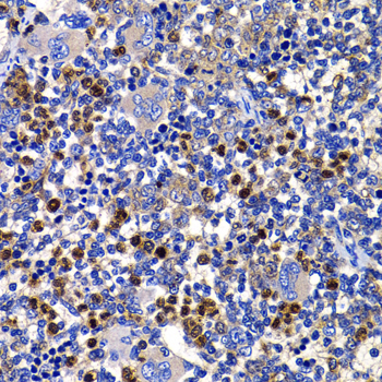 STAMBP Rabbit polyclonal antibody
