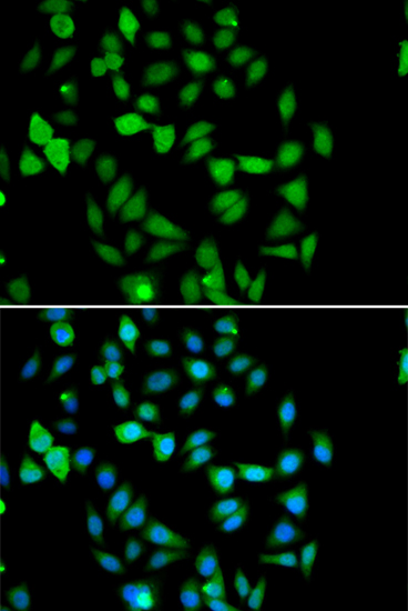 STAMBP Rabbit polyclonal antibody