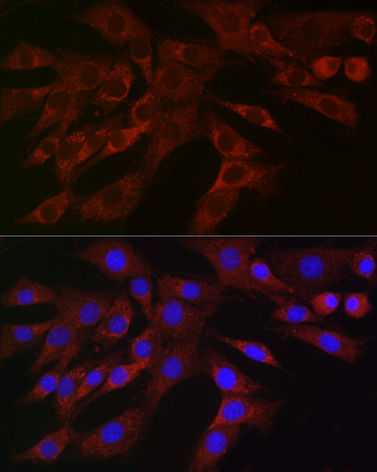 PLK2 Rabbit polyclonal antibody
