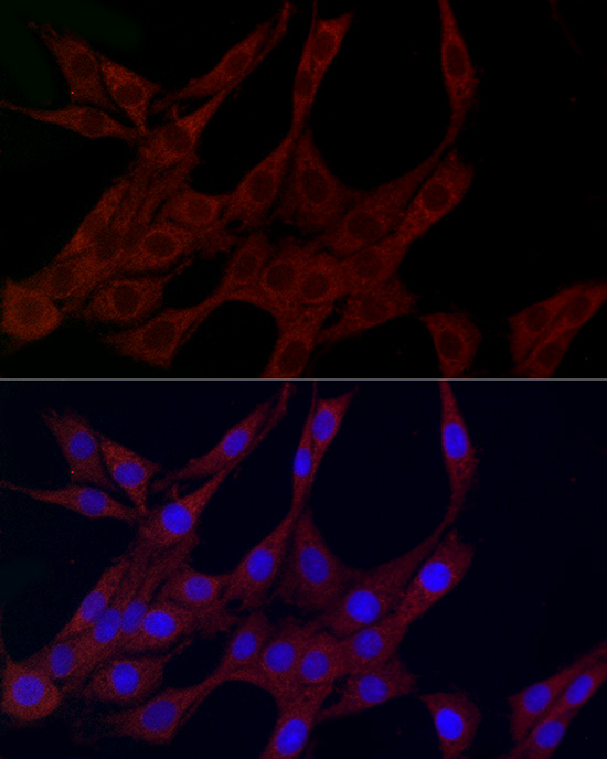 PLK2 Rabbit polyclonal antibody