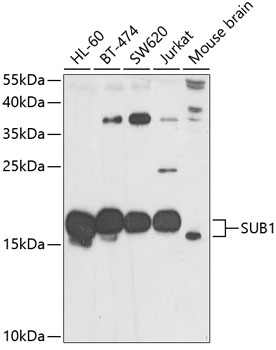 SUB1 Rabbit polyclonal antibody