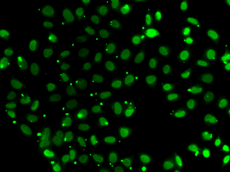 SUB1 Rabbit polyclonal antibody