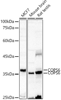 COPS6 Rabbit polyclonal antibody