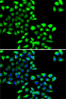COPS6 Rabbit polyclonal antibody