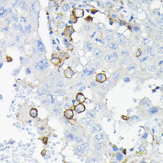 LILRB4 Rabbit polyclonal antibody