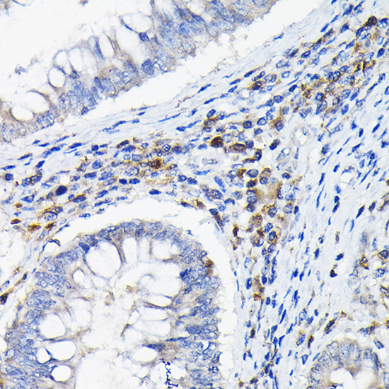 LILRB4 Rabbit polyclonal antibody