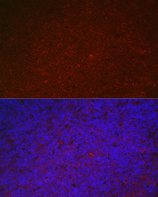LILRB4 Rabbit polyclonal antibody