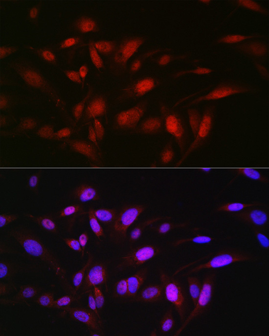 OGFR Rabbit polyclonal antibody
