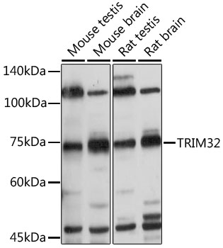 TRIM32 Rabbit polyclonal antibody