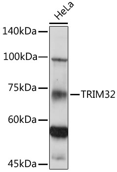 TRIM32 Rabbit polyclonal antibody
