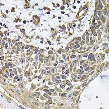 ICOSL Rabbit polyclonal antibody