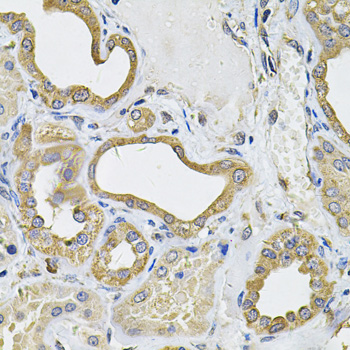 ICOSL Rabbit polyclonal antibody