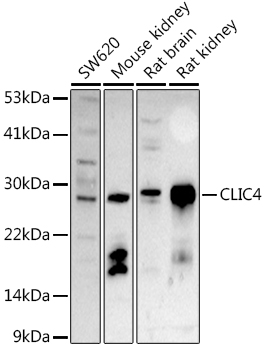 CLIC4 Rabbit polyclonal antibody