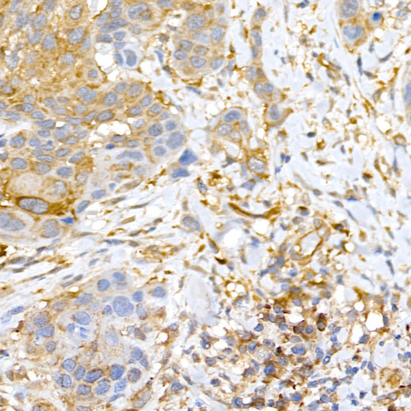CLIC4 Rabbit polyclonal antibody