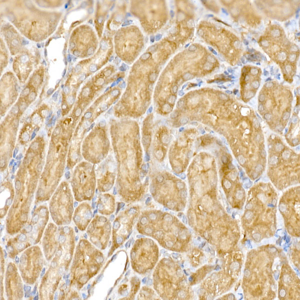 CLIC4 Rabbit polyclonal antibody