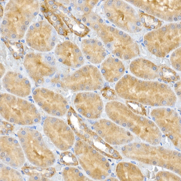 CLIC4 Rabbit polyclonal antibody