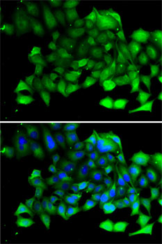 CLIC4 Rabbit polyclonal antibody