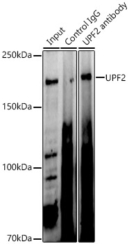UPF2 Rabbit polyclonal antibody