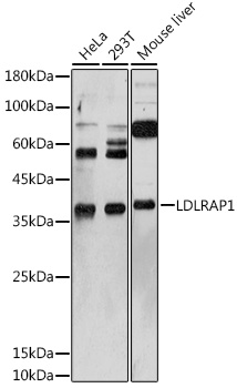 LDLRAP1 Rabbit polyclonal antibody