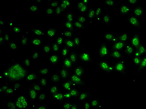 LDLRAP1 Rabbit polyclonal antibody