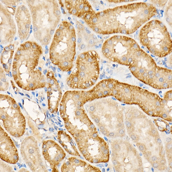 TES Rabbit polyclonal antibody