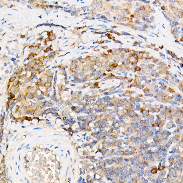TES Rabbit polyclonal antibody