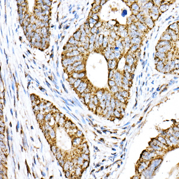 VPS4A Rabbit polyclonal antibody
