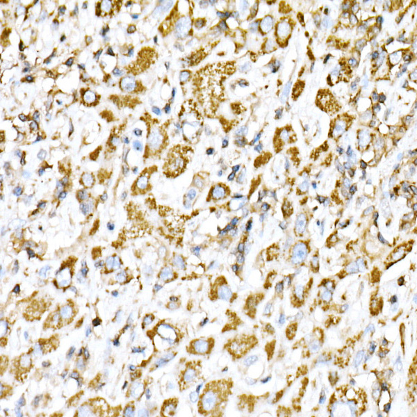 VPS4A Rabbit polyclonal antibody