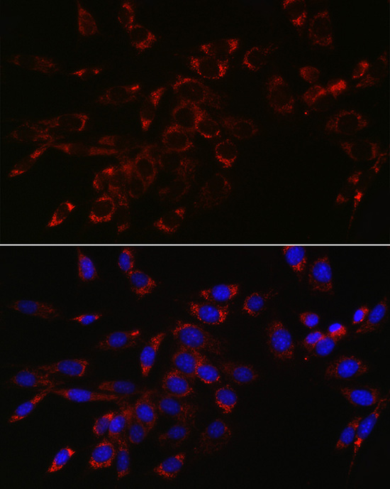 VPS4A Rabbit polyclonal antibody