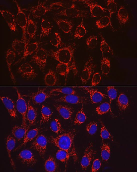 VPS4A Rabbit polyclonal antibody