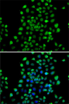 NTMT1 Rabbit polyclonal antibody