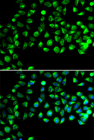 C16orf80 Rabbit polyclonal antibody