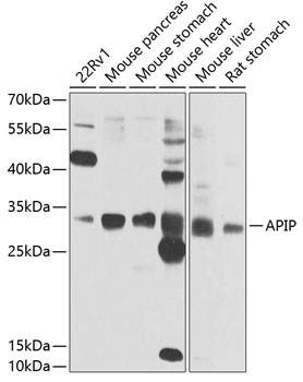 APIP Rabbit polyclonal antibody