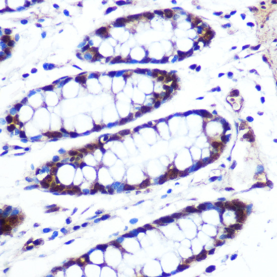 APIP Rabbit polyclonal antibody
