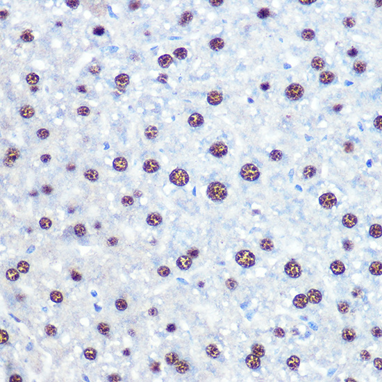 APIP Rabbit polyclonal antibody