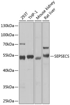 SEPSECS Rabbit polyclonal antibody