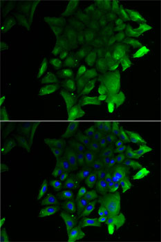 SEPSECS Rabbit polyclonal antibody