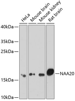 NAA20 Rabbit polyclonal antibody