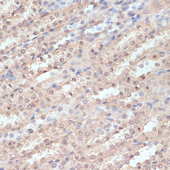 NAA20 Rabbit polyclonal antibody
