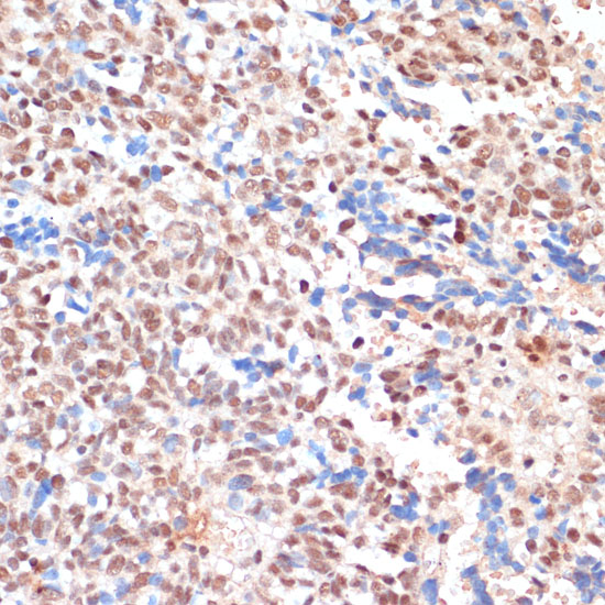 NAA20 Rabbit polyclonal antibody
