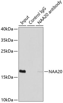 NAA20 Rabbit polyclonal antibody