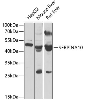 SERPINA10 Rabbit polyclonal antibody