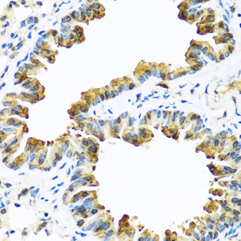 SERPINA10 Rabbit polyclonal antibody