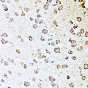 SERPINA10 Rabbit polyclonal antibody