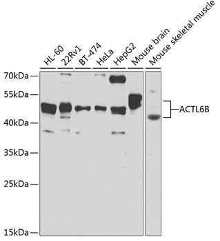 ACTL6B Rabbit polyclonal antibody