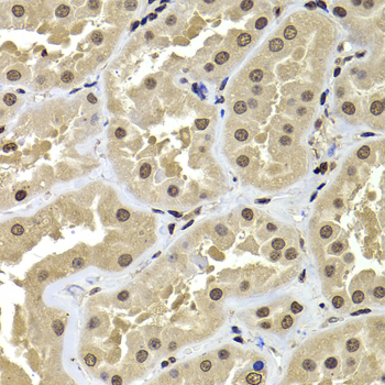 ACTL6B Rabbit polyclonal antibody