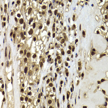 ACTL6B Rabbit polyclonal antibody